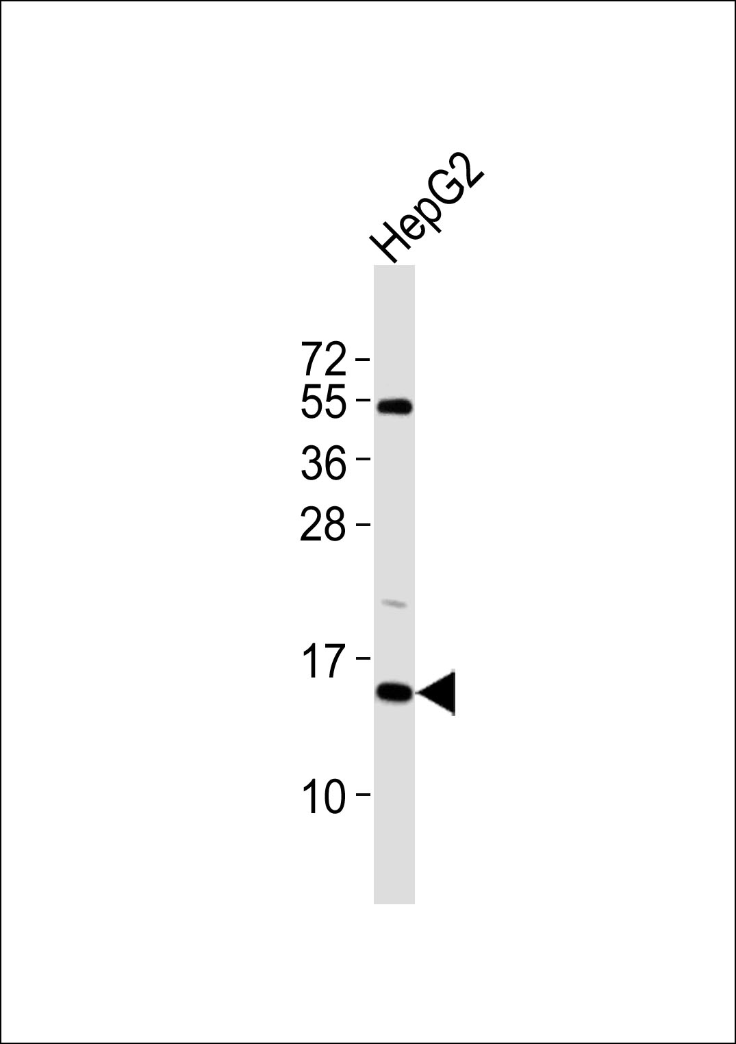 Anti-SAP14 Antibodyat 1:1000 dilution + HepG2 whole cell lysates Lysates/proteins at 20 µg per lane. Secondary Goat Anti-Rabbit IgG, (H+L),Peroxidase conjugated at 1/10000 dilution Predicted band size : 15 kDa Blocking/Dilution buffer: 5% NFDM/TBST.