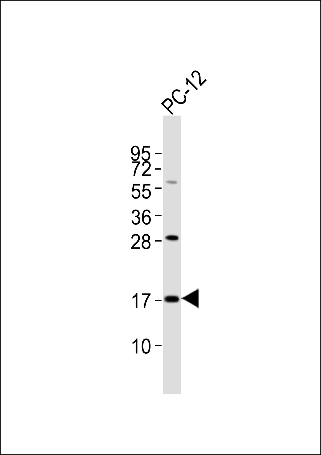Anti-SFT2D2 Antibodyat 1:1000 dilution + PC-12 whole cell lysates Lysates/proteins at 20 µg per lane. Secondary Goat Anti-Rabbit IgG, (H+L),Peroxidase conjugated at 1/10000 dilution Predicted band size : 18 kDa Blocking/Dilution buffer: 5% NFDM/TBST.