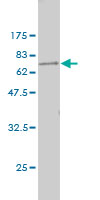 Antibody Reactive Against Recombinant Protein.Western Blot detection against Immunogen (64.24 KDa) . 