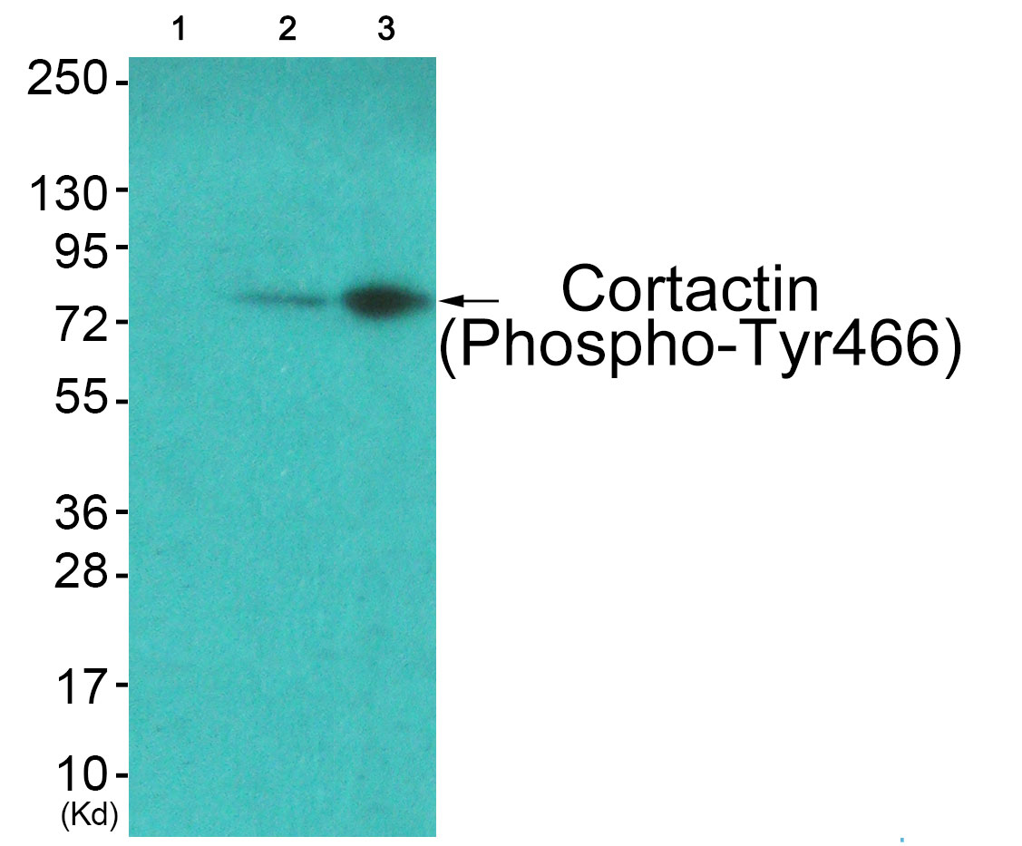 Western blot analysis of extracts from COS7 cells (Lane 2) and JK cells (Lane 3), using Cortactin (Phospho-Tyr466) Antibody. The lane on the left is treated with synthesized peptide.