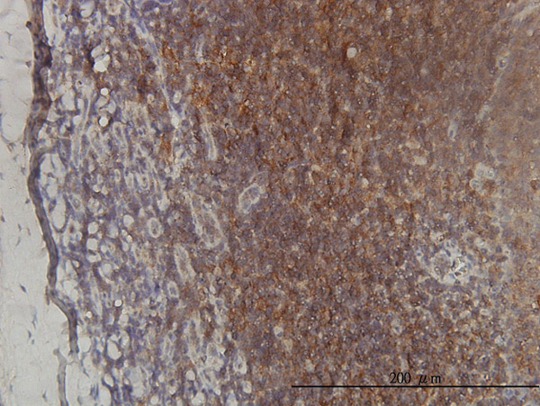 Immunoperoxidase of monoclonal antibody to ST3GAL2 on formalin-fixed paraffin-embedded human tonsil tissue. [antibody concentration 1 ~ 10 ug/ml]