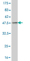 Antibody Reactive Against Recombinant Protein.Western Blot detection against Immunogen (42.02 KDa) . 