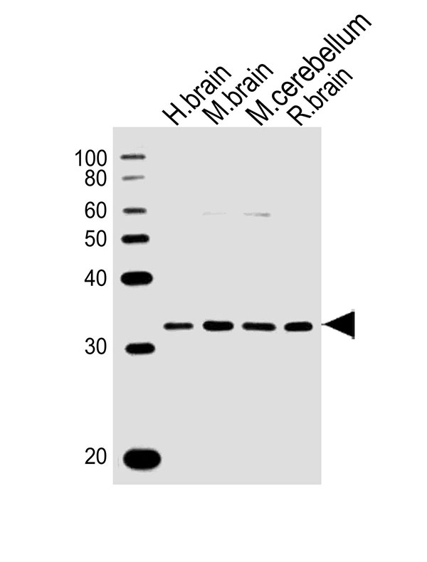 All lanes : Anti-PCGF1 Antibody (Center) at 1:1000 dilution Lane 1: human brain lysates Lane 2: mouse brain lysates Lane 3: mouse cerebellum lysates Lane 4: rat brain lysates Lysates/proteins at 20 µg per lane. Secondary Goat Anti-Rabbit IgG, (H+L),Peroxidase conjugated at 1/10000 dilution Predicted band size : 30 kDa Blocking/Dilution buffer: 5% NFDM/TBST.