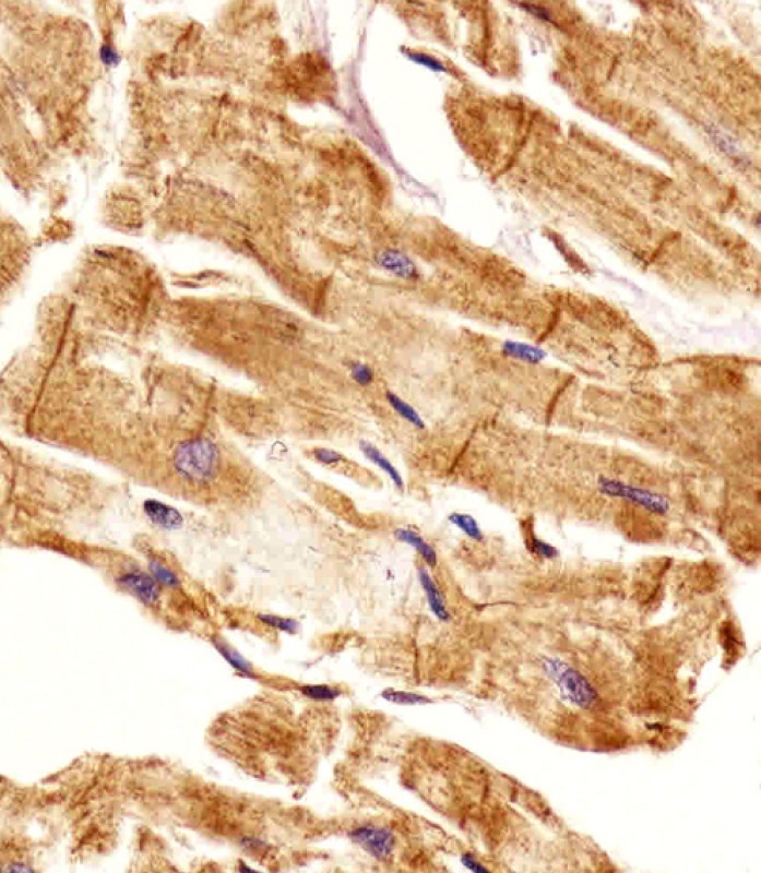 Immunohistochemical analysis of paraffin-embedded H. heart section using EHD2 Antibody (C-term)(Cat# AW5422). AW5422 was diluted at 1:25 dilution. A undiluted biotinylated goat polyvalent antibody was used as the secondary, followed by DAB staining.