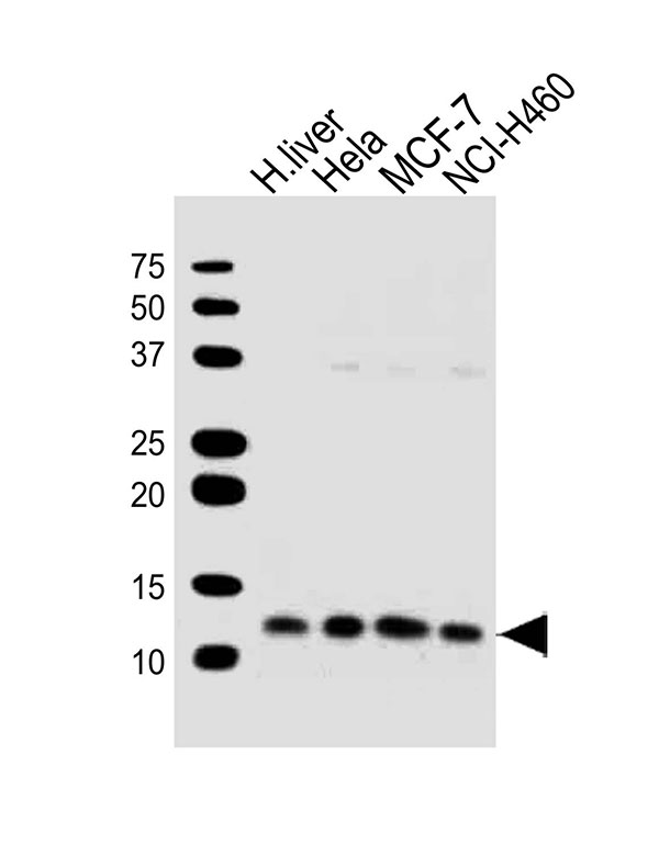 All lanes : Anti-UQCRQ Antibody (N-term) at 1:1000 dilution Lane 1: human liver lysates Lane 2: Hela whole cell lysates Lane 3: MCF-7 whole cell lysates Lane 4: NCI-H460 whole cell lysates Lysates/proteins at 20 µg per lane. Secondary Goat Anti-Rabbit IgG, (H+L),Peroxidase conjugated at 1/10000 dilution Predicted band size : 10 kDa Blocking/Dilution buffer: 5% NFDM/TBST.