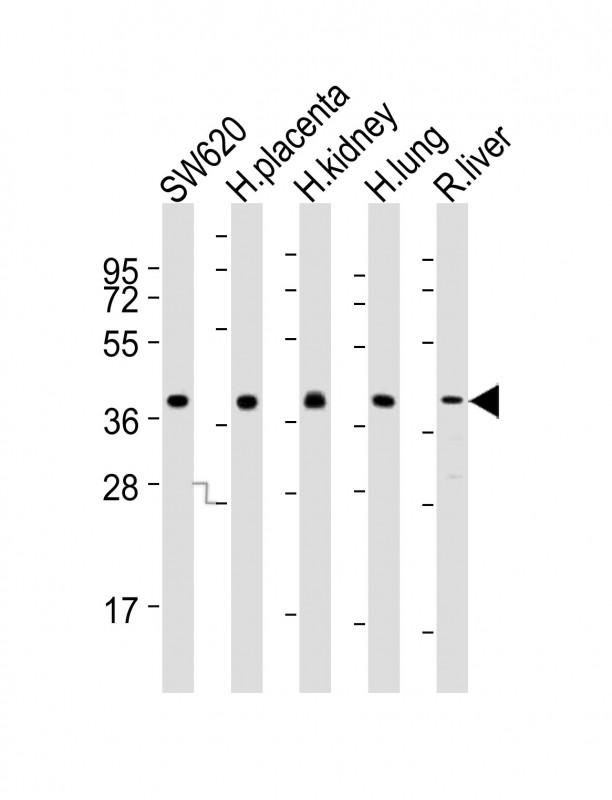 All lanes : Anti-PPAP2B Antibody (N-term) at 1:2000 dilution Lane 1: SW620 whole cell lysates Lane 2: human placenta lysates Lane 3: human kidney lysates Lane 4: human lung lysates Lane 5: rat liver lysates Lysates/proteins at 20 µg per lane. Secondary Goat Anti-Rabbit IgG, (H+L), Peroxidase conjugated at 1/10000 dilution Predicted band size : 35 kDa Blocking/Dilution buffer: 5% NFDM/TBST.