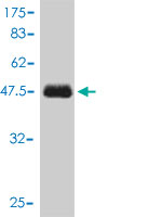 Antibody Reactive Against Recombinant Protein.Western Blot detection against Immunogen (46.64 KDa) . 