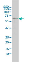 SRCRB4D monoclonal antibody (M01), clone 3D9 Western Blot analysis of SRCRB4D expression in C32 ( (Cat # AT4034a )