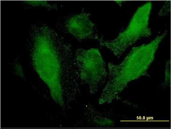 Immunofluorescence of monoclonal antibody to SRCRB4D on HeLa cell. [antibody concentration 10 ug/ml]