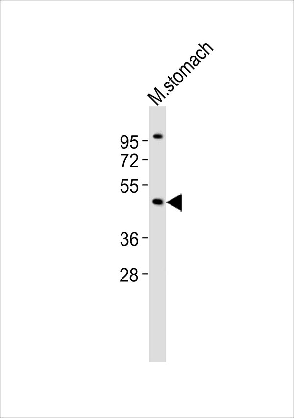 Anti-ARRDC1 Antibodyat 1:1000 dilution + mouse stomach lysates Lysates/proteins at 20 µg per lane. Secondary Goat Anti-Rabbit IgG, (H+L),Peroxidase conjugated at 1/10000 dilution Predicted band size : 46 kDa Blocking/Dilution buffer: 5% NFDM/TBST.