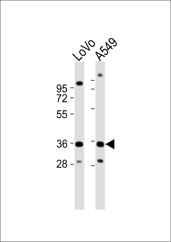 All lanes : Anti-HOXB2 Antibody at 1:1000 dilution Lane 1: LoVo whole cell lysates Lane 2: A549 whole cell lysates Lysates/proteins at 20 µg per lane. Secondary Goat Anti-Rabbit IgG, (H+L),Peroxidase conjugated at 1/10000 dilution Predicted band size : 38 kDa Blocking/Dilution buffer: 5% NFDM/TBST.