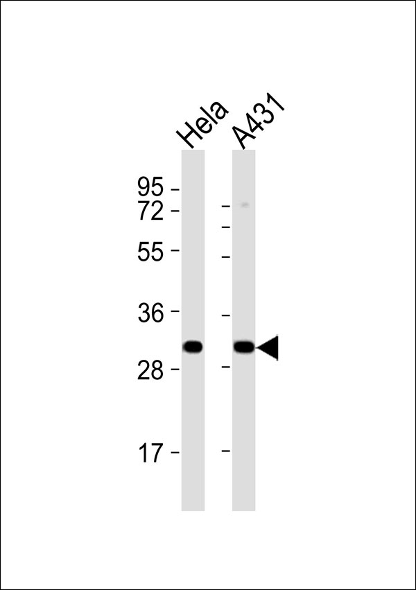 All lanes : Anti-RPS4Y1 Antibody at 1:1000 dilution Lane 1: Hela whole cell lysates Lane 2: A431 whole cell lysates Lysates/proteins at 20 µg per lane. Secondary Goat Anti-Rabbit IgG, (H+L),Peroxidase conjugated at 1/10000 dilution Predicted band size : 29 kDa Blocking/Dilution buffer: 5% NFDM/TBST.
