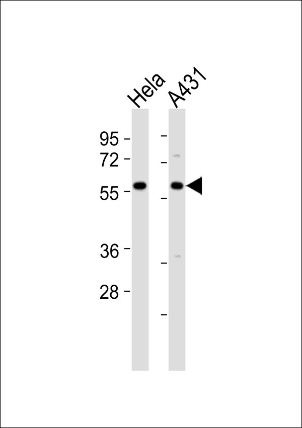 All lanes : Anti-TCP1 theta Antibody at 1:1000 dilution Lane 1: Hela whole cell lysates Lane 2: A431 whole cell lysates Lysates/proteins at 20 µg per lane. Secondary Goat Anti-Rabbit IgG, (H+L),Peroxidase conjugated at 1/10000 dilution Predicted band size : 60 kDa Blocking/Dilution buffer: 5% NFDM/TBST.