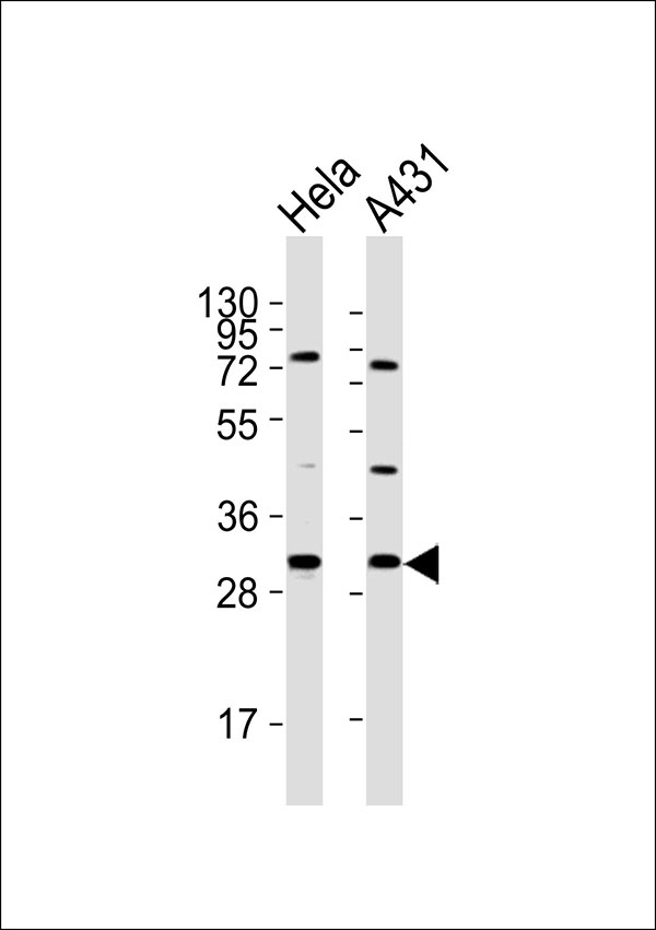 All lanes : Anti-RPS4X Antibody at 1:1000 dilution Lane 1: Hela whole cell lysates Lane 2: A431 whole cell lysates Lysates/proteins at 20 µg per lane. Secondary Goat Anti-Rabbit IgG, (H+L),Peroxidase conjugated at 1/10000 dilution Predicted band size : 30 kDa Blocking/Dilution buffer: 5% NFDM/TBST.