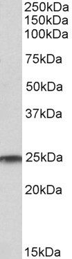 AF3095a (0.01 µg/ml) staining of Human Cerebellum (A), Duodenum (B) and Heart (C) cell lysates (35 µg protein in RIPA buffer). Primary incubation was 1 hour. Detected by chemiluminescence.