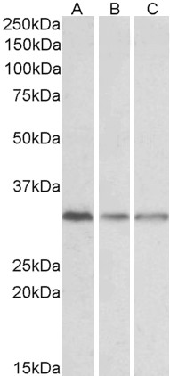 AF3521a (0.3 µg/ml) staining of Human Cerebral Cortex (A), Human Frontal Cortex (B) and Mouse Brain lysates (35 µg protein in RIPA buffer). Primary incubation was 1 hour. Detected by chemiluminescence.