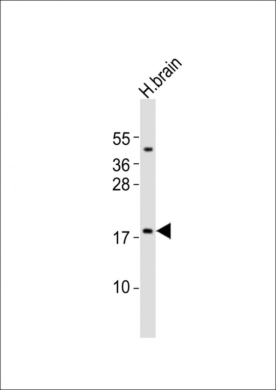 Anti-CALY Antibody (N-term)at 1:2000 dilution + human brain lysates Lysates/proteins at 20 µg per lane. Secondary Goat Anti-Rabbit IgG, (H+L), Peroxidase conjugated at 1/10000 dilution Predicted band size : 23 kDa Blocking/Dilution buffer: 5% NFDM/TBST.