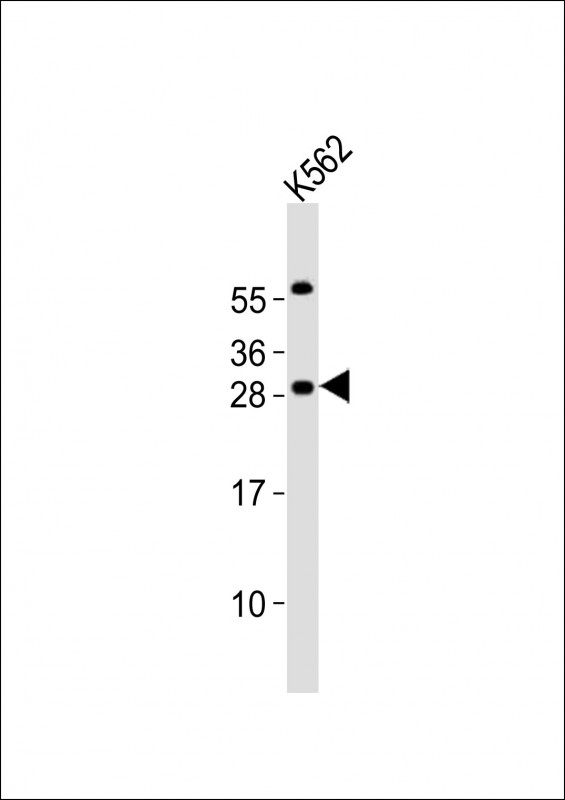 Anti-PCGF1 Antibody (Center)at 1:2000 dilution + K562 whole cell lysates Lysates/proteins at 20 µg per lane. Secondary Goat Anti-Rabbit IgG, (H+L), Peroxidase conjugated at 1/10000 dilution Predicted band size : 30 kDa Blocking/Dilution buffer: 5% NFDM/TBST.