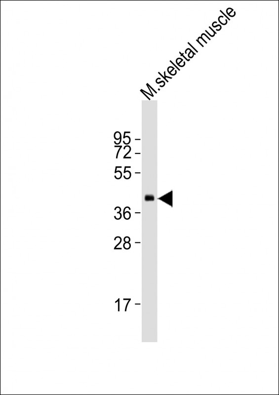 Anti-B4GALT7 Antibody (N-term)at 1:2000 dilution + mouse skeletal muscle lysates Lysates/proteins at 20 µg per lane. Secondary Goat Anti-Rabbit IgG, (H+L), Peroxidase conjugated at 1/10000 dilution Predicted band size : 37 kDa Blocking/Dilution buffer: 5% NFDM/TBST.