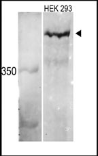 Western blot analysis of MLL3 Antibody (C-term) (Cat.#AP6184a) in HEK 293 cell line lysates. MLL3 (arrow) was detected using the purified Pab.