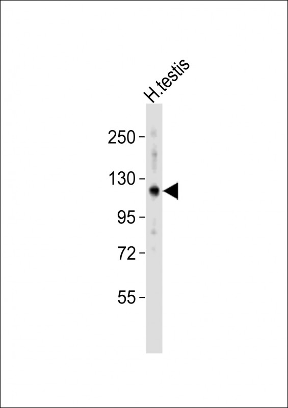 Anti-HERC4 Antibody (Center)at 1:2000 dilution + human testis lysates Lysates/proteins at 20 µg per lane. Secondary Goat Anti-Rabbit IgG, (H+L), Peroxidase conjugated at 1/10000 dilution Predicted band size : 119 kDa Blocking/Dilution buffer: 5% NFDM/TBST.
