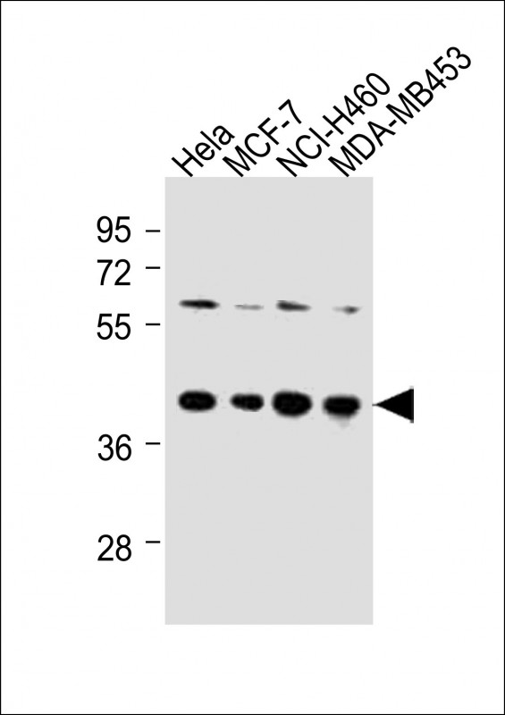 All lanes : Anti-LAPTM4B-4 Antibody at 1:250 dilution Lane 1: Hela whole cell lysates Lane 2: MCF-7 whole cell lysates Lane 3: NCI-H460 whole cell lysates Lane 4: MDA-MB453 whole cell lysates Lysates/proteins at 20 µg per lane. Secondary Goat Anti-Rabbit IgG, (H+L), Peroxidase conjugated at 1/10000 dilution Predicted band size : 41 kDa Blocking/Dilution buffer: 5% NFDM/TBST.