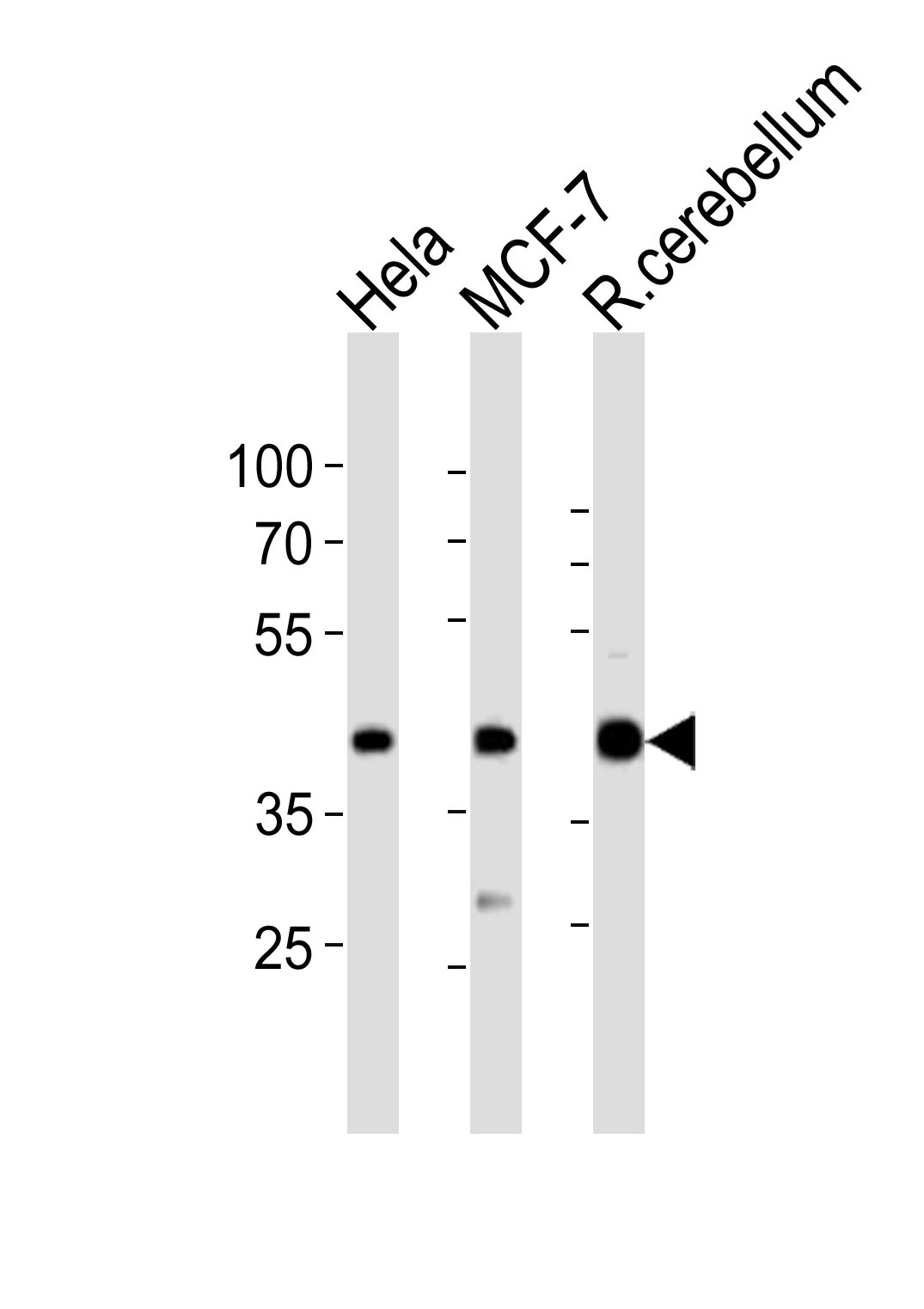 Western blot analysis of lysates from Hela, MCF-7 cell line, rat cerebellum tissue lysate(from left to right), using LAPTM4B Antibody (4)(Cat. #AP20871a). AP20871a was diluted at 1:1000 at each lane. A goat anti-rabbit IgG H&L(HRP) at 1:10000 dilution was used as the secondary antibody. Lysates at 20ug per lane.