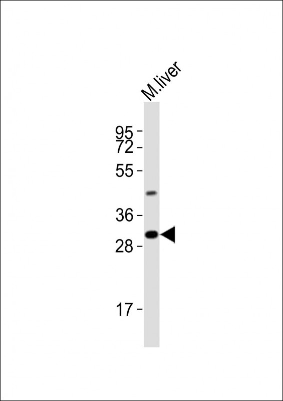 Anti-Utf1 Antibody (C-term)at 1:2000 dilution + mouse liver lysates Lysates/proteins at 20 µg per lane. Secondary Goat Anti-Rabbit IgG, (H+L), Peroxidase conjugated at 1/10000 dilution Predicted band size : 36 kDa Blocking/Dilution buffer: 5% NFDM/TBST.