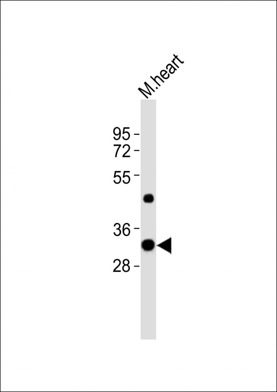 Anti-Utf1 Antibody (C-term)at 1:8000 dilution + mouse heart lysates Lysates/proteins at 20 µg per lane. Secondary Goat Anti-Rabbit IgG, (H+L), Peroxidase conjugated at 1/10000 dilution Predicted band size : 36 kDa Blocking/Dilution buffer: 5% NFDM/TBST.
