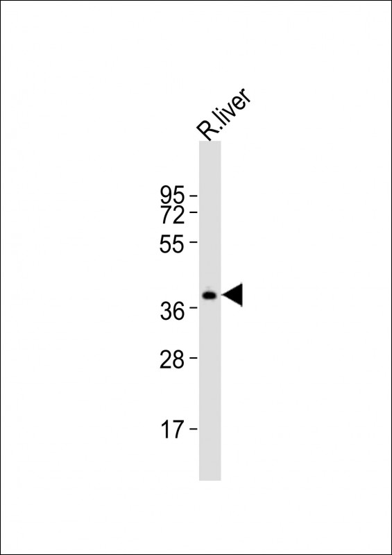Anti-Trex2 Antibody (C-term)at 1:1000 dilution + rat liver lysates Lysates/proteins at 20 µg per lane. Secondary Goat Anti-Rabbit IgG, (H+L), Peroxidase conjugated at 1/10000 dilution Predicted band size : 26 kDa Blocking/Dilution buffer: 5% NFDM/TBST.