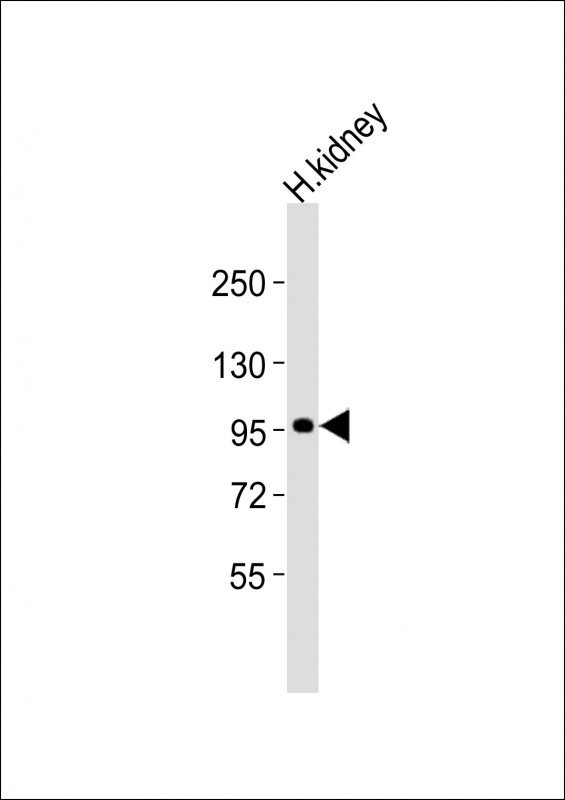 Anti-ADAMTS6 Antibody (N-Term)at 1:2000 dilution + human kidney lysates Lysates/proteins at 20 µg per lane. Secondary Goat Anti-Rabbit IgG, (H+L), Peroxidase conjugated at 1/10000 dilution Predicted band size : 125 kDa Blocking/Dilution buffer: 5% NFDM/TBST.