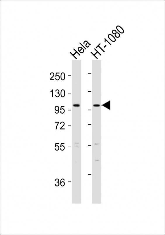 All lanes : Anti-ADAMTS6 Antibody (N-Term) at 1:2000 dilution Lane 1: Hela whole cell lysates Lane 2: HT-1080 whole cell lysates Lysates/proteins at 20 µg per lane. Secondary Goat Anti-Rabbit IgG, (H+L), Peroxidase conjugated at 1/10000 dilution Predicted band size : 125 kDa Blocking/Dilution buffer: 5% NFDM/TBST.