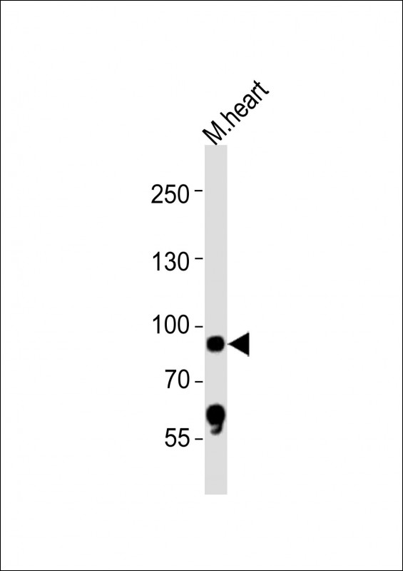 Anti-Rps6ka5 Antibody (C-term)at 1:4000 dilution + mouse heart lysates Lysates/proteins at 20 µg per lane. Secondary Goat Anti-Rabbit IgG, (H+L), Peroxidase conjugated at 1/10000 dilution Predicted band size : 97 kDa Blocking/Dilution buffer: 5% NFDM/TBST.