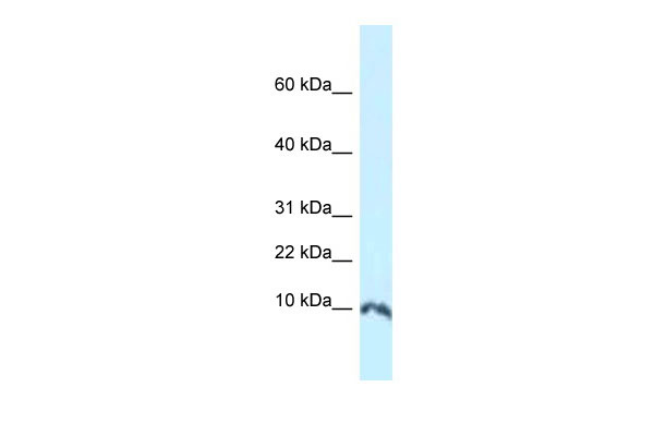 WB Suggested Anti-Sumo1 Antibody Titration: 1. ug/ml Positive Control: Mouse Thymus