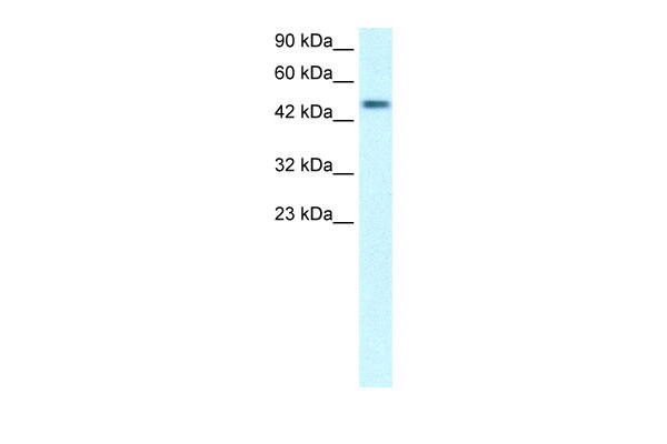 WB Suggested Anti-C5orf41 Antibody Titration: .2-1 ug/ml Positive Control: Human Lung