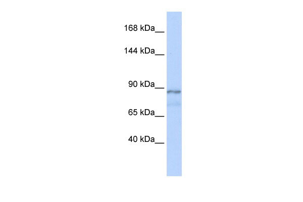 WB Suggested Anti-ZFAT1 Antibody Titration: .2-1 ug/ml ELISA Titer: 1:3125 Positive Control: Human Muscle