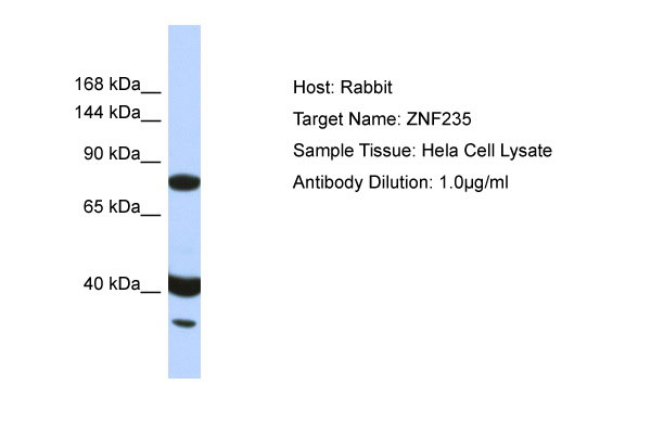 Host: Rabbit Target Name: ZNF235 Sample Tissue: Hela Whole Cell lysates Antibody Dilution: 1.ug/ml