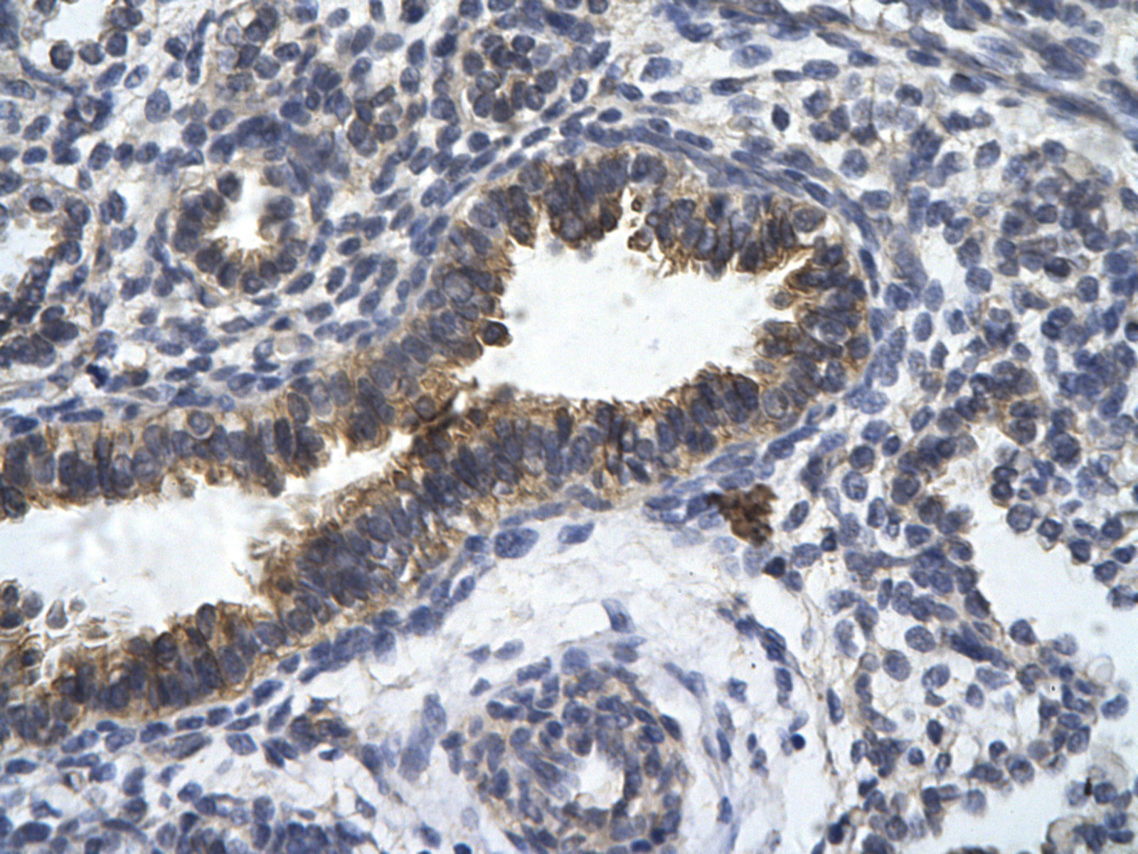 Rabbit Anti-ZFR Antibody Catalog Number: ARP34527 Paraffin Embedded Tissue: Human bronchiole epithelium Cellular Data: Epithelial cells of renal tubule Antibody Concentration: 4.0-8.0 ug/ml Magnification: 400X