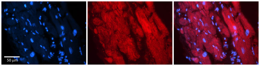 Rabbit Anti-ZFR Antibody Catalog Number: AI10682 Formalin Fixed Paraffin Embedded Tissue: Human Adult heart Observed Staining: Cytoplasmic Primary Antibody Concentration: 1:600 Secondary Antibody: Donkey anti-Rabbit-Cy2/3 Secondary Antibody Concentration: 1:200 Magnification: 20X Exposure Time: 0.5 – 2.0 sec Protocol located in Reviews and Data.