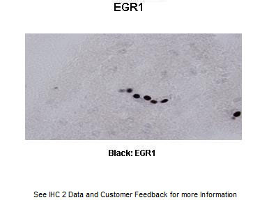 Sample Type : Frog brain Primary Antibody Dilution : 1:500 Secondary Antibody : Biotinylated goat anti-rabbit Secondary Antibody Dilution : 1:200 Color/Signal Descriptions : Black: EGR1 Gene Name : Egr1 a Submitted by : Eva Fischer, Colorado State University