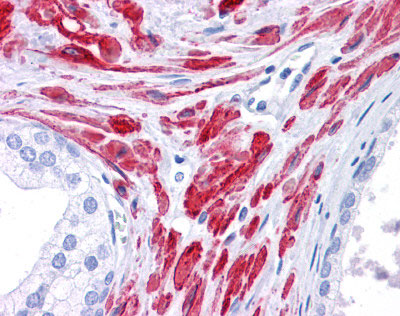 Human Prostate