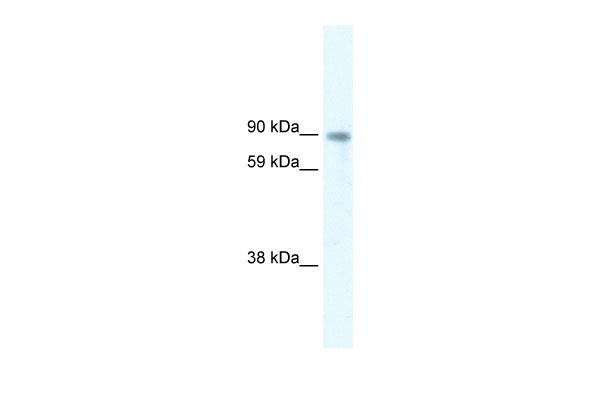 WB Suggested Anti-STAT5B Antibody Titration: 5.0ug/ml Positive Control: Muscle lysate