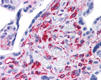Human Prostate