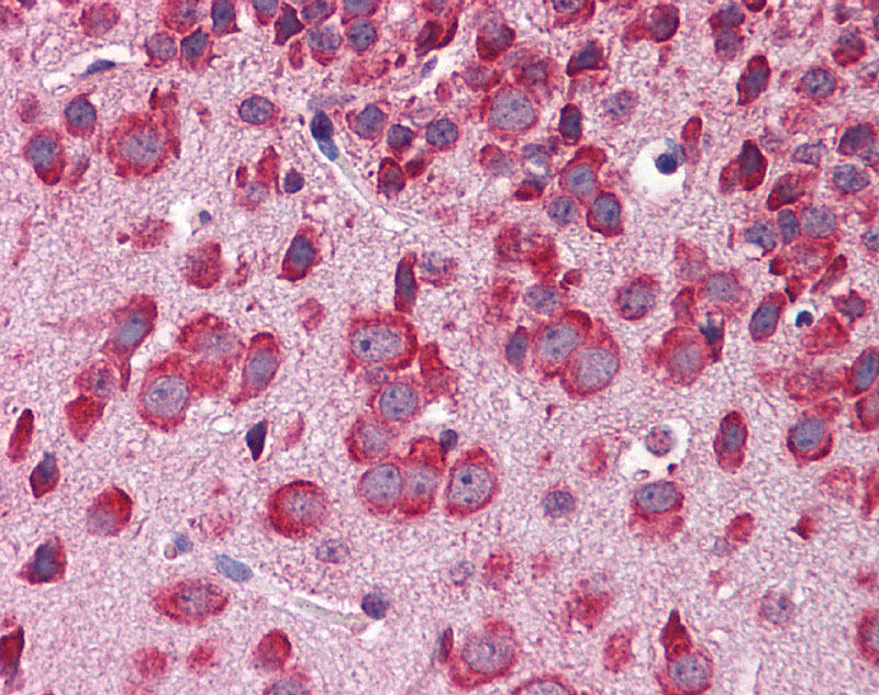 Mouse Brain