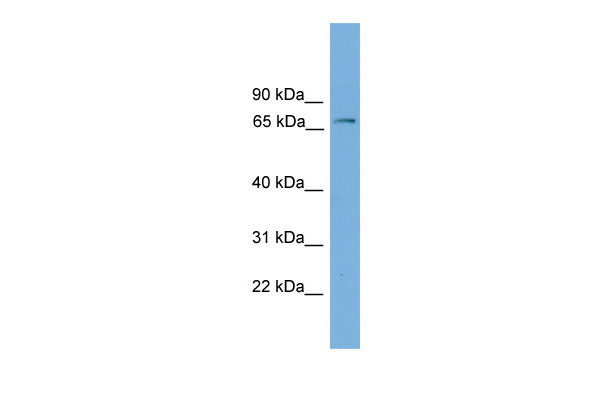 WB Suggested Anti-Fbxw7 Antibody Titration: 0.2-1 ug/ml Positive Control: Mouse Lung