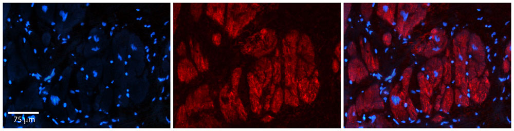 Rabbit Anti-Zfr Antibody Catalog Number: AI11515 Formalin Fixed Paraffin Embedded Tissue: Human Adult heart Observed Staining: Cytoplasmic Primary Antibody Concentration: 1:600 Secondary Antibody: Donkey anti-Rabbit-Cy2/3 Secondary Antibody Concentration: 1:200 Magnification: 20X Exposure Time: 0.5 â€“ 2.0 sec Protocol located in Reviews and Data.