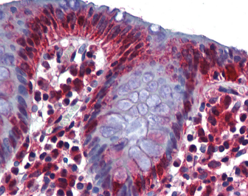 human Colon
