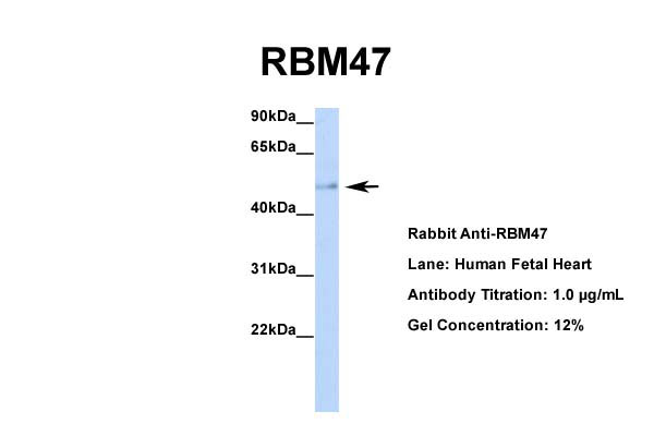 Host: Rabbit Target Name: RBM47 Sample Tissue: Human Fetal Heart Antibody Dilution: 1.0ug/ml