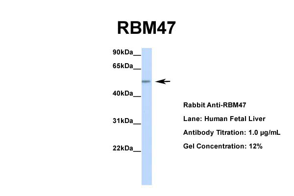 Host: Rabbit Target Name: RBM47 Sample Tissue: Human Fetal Liver Antibody Dilution: 1.0ug/ml