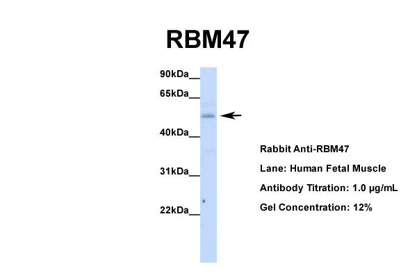 Host: Rabbit Target Name: RBM47 Sample Tissue: Human Fetal Muscle Antibody Dilution: 1.0ug/ml